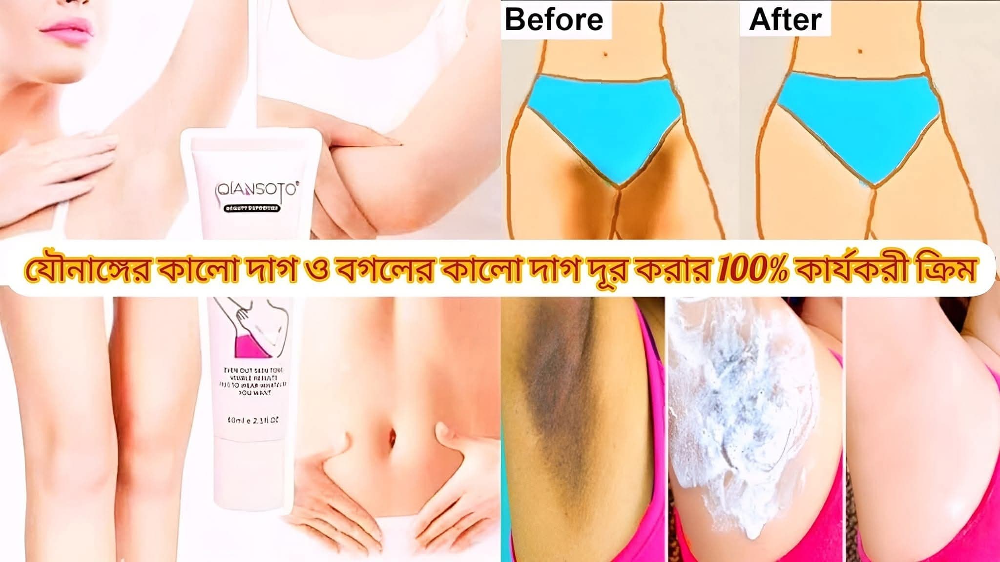 গোপনাঙ্গ টাইট ও কালো দাগ দূর করার জন্য?